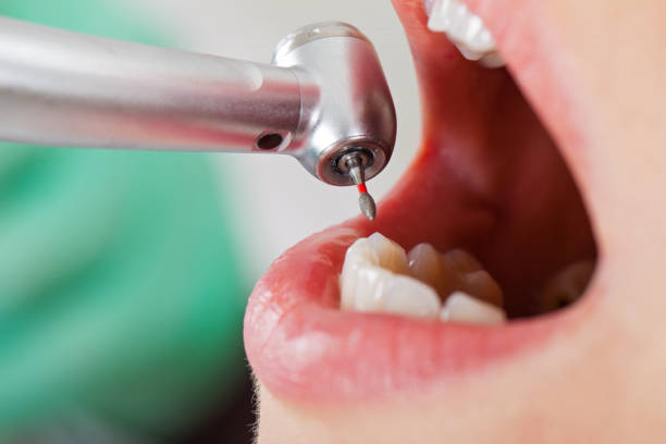 Best Tooth Pain Emergency Relief  in Rancho Cordova, CA